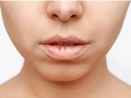 सर्दियों में फट रहे होंठों के लिए घर पर बनाएं नेचुरल लिप बाम, होंठ रहेंगे ग्लोसी और सॉफ्ट