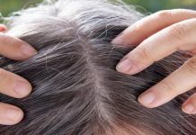 कम उम्र में सफेद बालों से परेशान? सूखा आंवला बन सकता है देसी समाधान