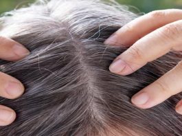 कम उम्र में सफेद बालों से परेशान? सूखा आंवला बन सकता है देसी समाधान