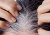 सफेद बालों से राहत पाने के लिए अपनाएं आंवला का नेचुरल नुस्खा