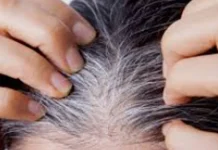 सफेद बालों से राहत पाने के लिए अपनाएं आंवला का नेचुरल नुस्खा