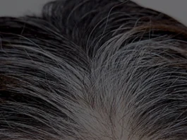 कम उम्र में सफेद बालों से परेशान लोगों के लिए देसी नुस्खा, सूखे आंवले से मिल सकता है फायदा