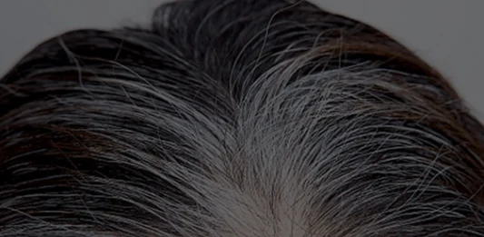कम उम्र में सफेद बालों से परेशान लोगों के लिए देसी नुस्खा, सूखे आंवले से मिल सकता है फायदा