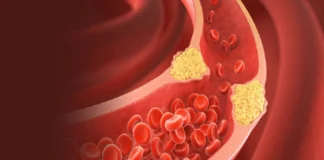 हाई कोलेस्ट्रॉल बना ‘साइलेंट किलर’, दिल की सेहत पर मंडरा रहा बड़ा खतरा