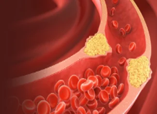 हाई कोलेस्ट्रॉल बना ‘साइलेंट किलर’, दिल की सेहत पर मंडरा रहा बड़ा खतरा