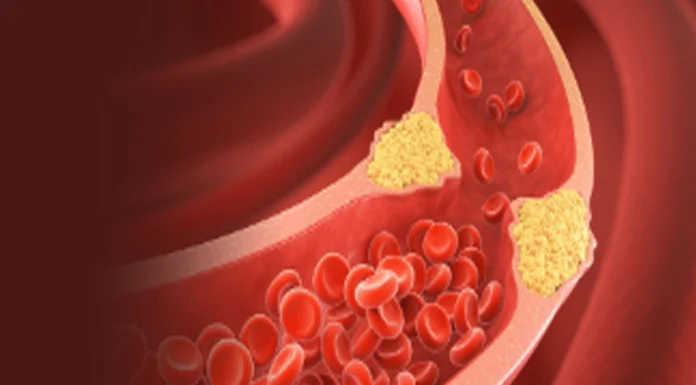 हाई कोलेस्ट्रॉल बना ‘साइलेंट किलर’, दिल की सेहत पर मंडरा रहा बड़ा खतरा